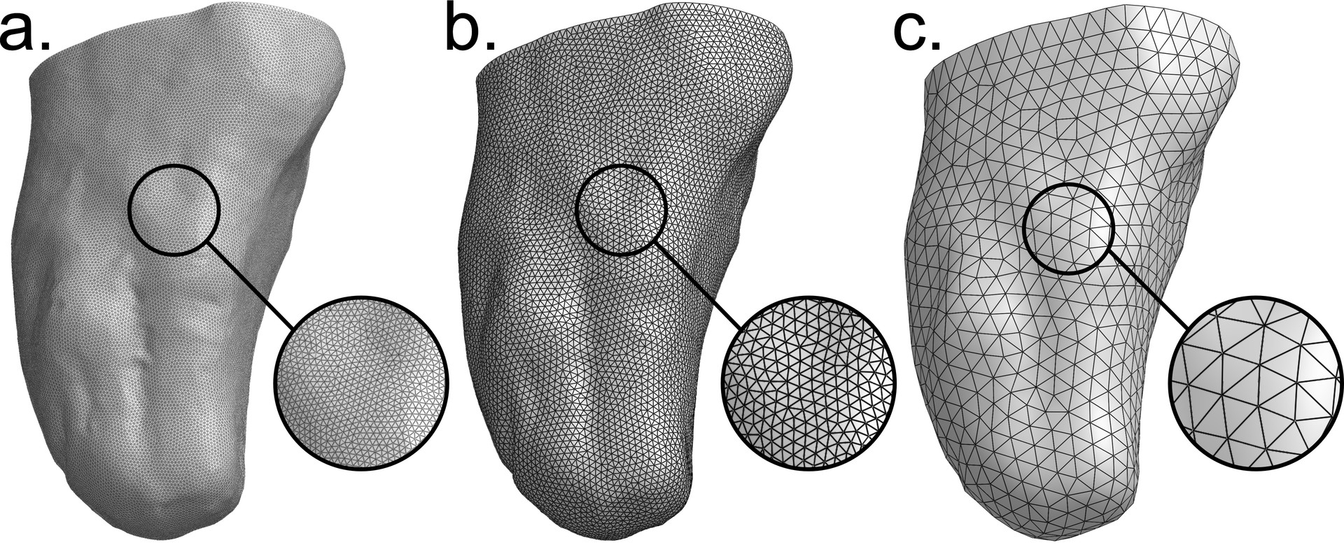 Residual limb mesh remeshed at three increasing resolutions